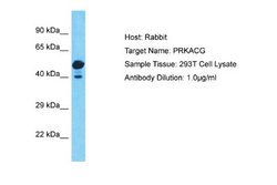 PKA C-gamma Rabbit anti-Human, Polyclonal, Novus Biologicals 0.1 mL | Buy Online | Novus Biologicals | Fisher Scientific